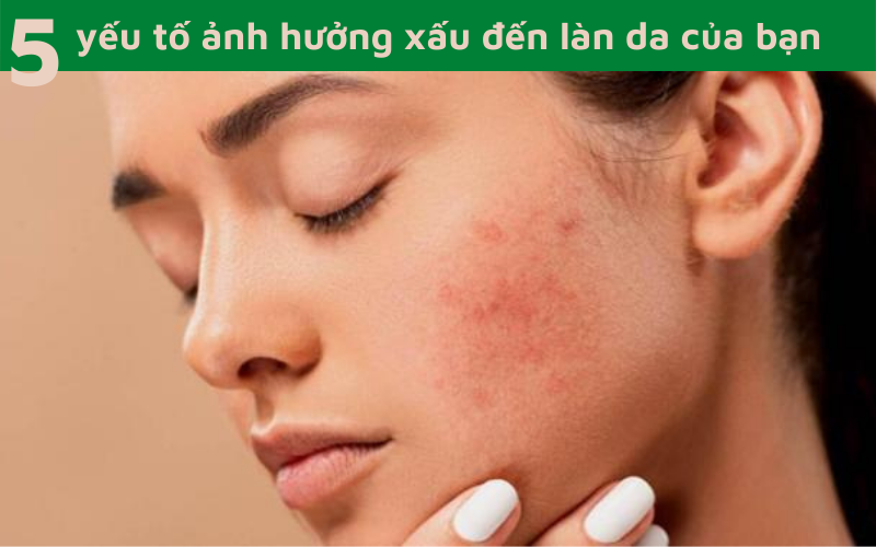 5 yếu tố ảnh hưởng xấu đến làn da của bạn