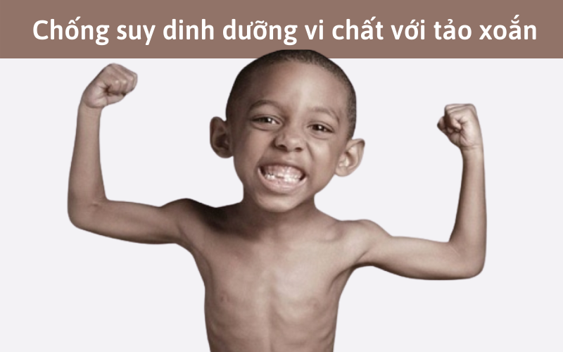 Chống suy dinh dưỡng vi chất với tảo xoắn