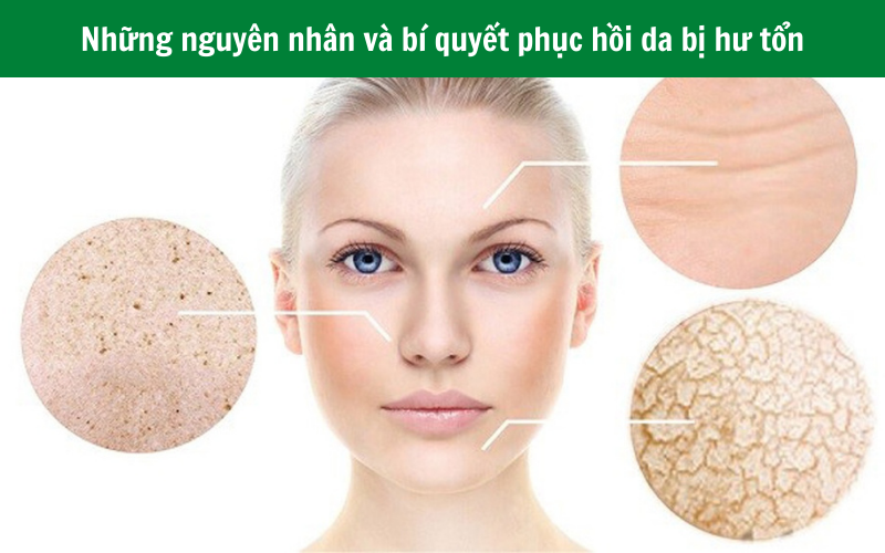 Những nguyên nhân hàng đầu và bí quyết phục hồi da bị hư tổn