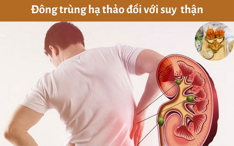 Đông trùng hạ thảo đối với suy  thận: Tác dụng và điều trị bệnh suy thận